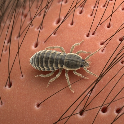 Microscopic view of head lice on human scalp