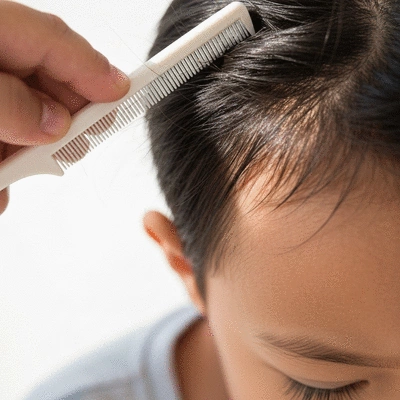 Close-up of a child's scalp being inspected for head lice, with a focus on hair strands and a nit comb, clean background, no text, no words, no typography, no labels, clean image