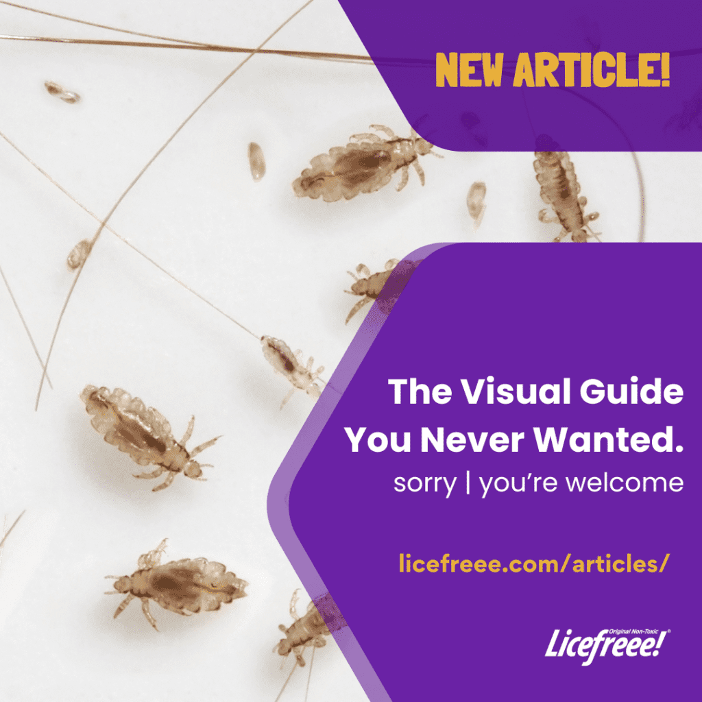 Lice Nits: A Visual Guide To Identification | Lice Nits