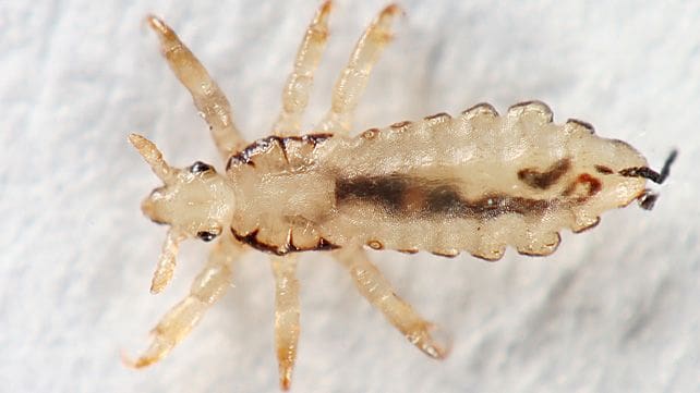 Most Popular Methods For Identifying Lice Nits