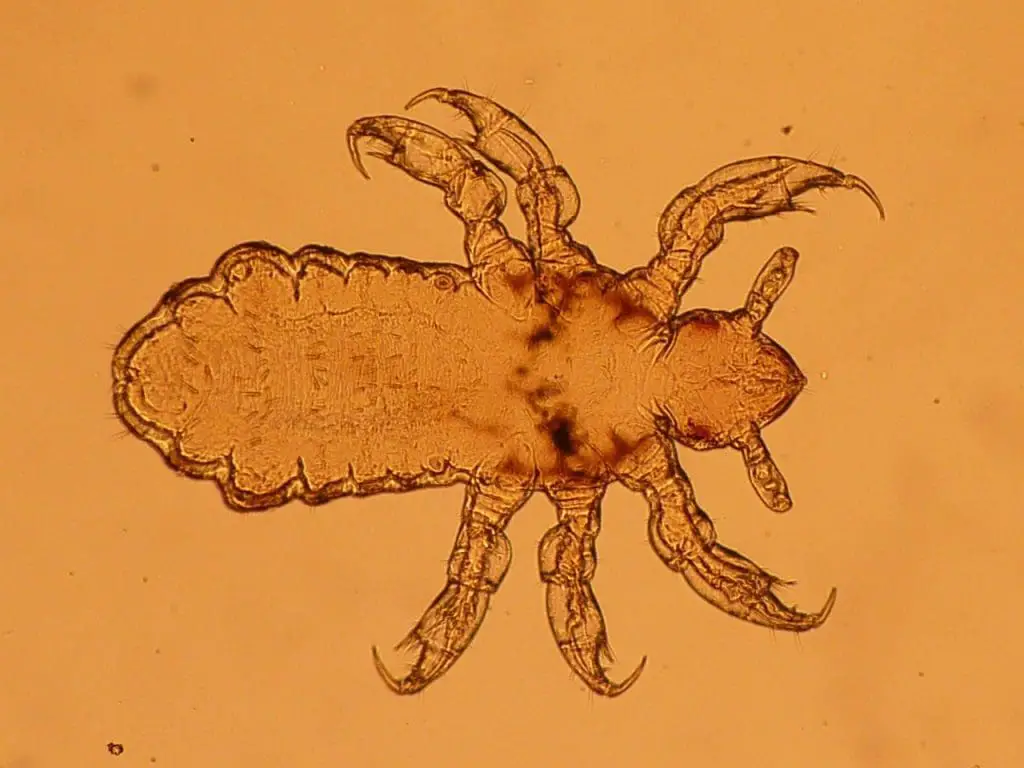 Quick Home Remedies For Lice Nits In Children