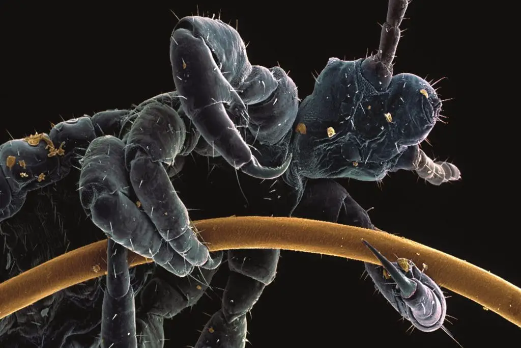 The Latest Technological Advancements In Lice Nit Detection