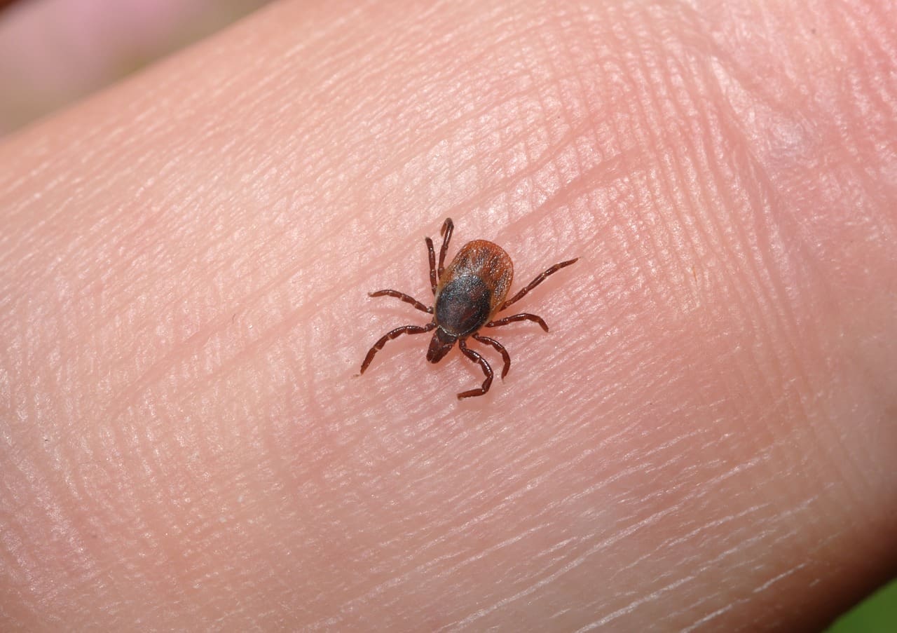 Best Lice Treatment For Individuals With Thin Or Fine Hair
