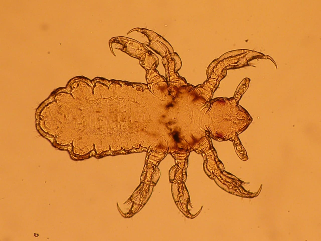 Lice Treatment Products For Sensitive Scalps: What You Need To Know