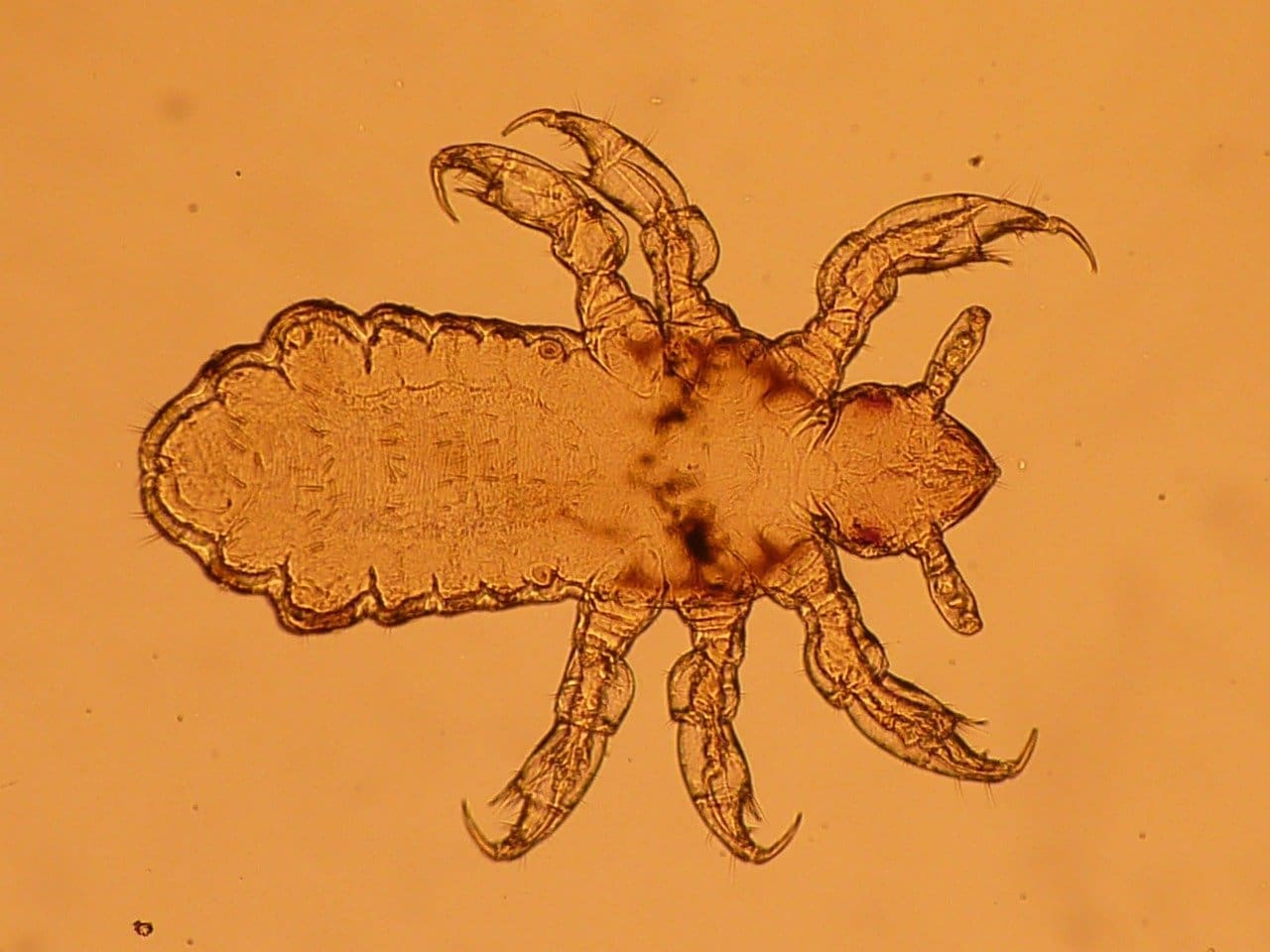 Most Popular Methods For Detecting Lice Nits In Adults